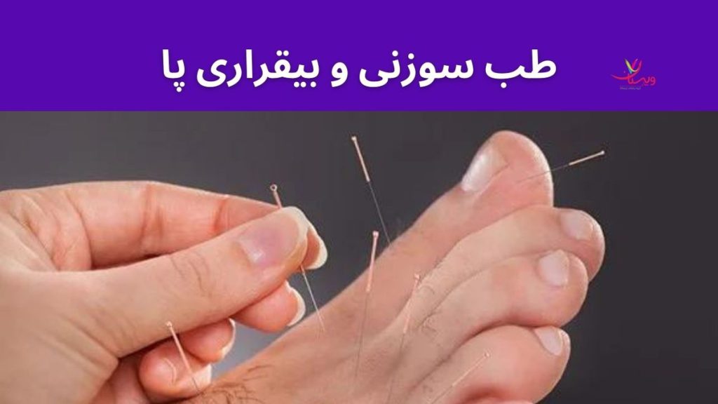 بیقراری در پاها تاثیر طب سوزنی برای سندرم پای بیقرار