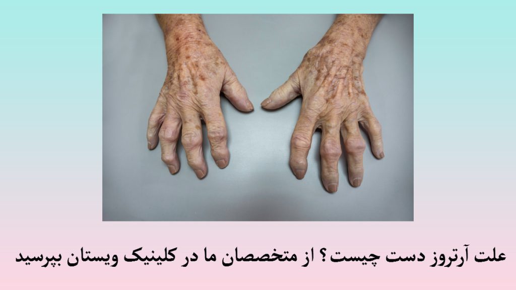 علت آرتروز دست دستها یک شخص مسن که انها را برای بیان علت آرتروز روی میز گذاشته است