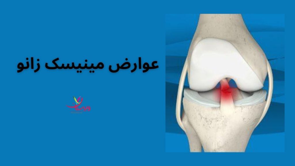 آرتروز زانو عوارض درمان نکردن مینیسک زانو
