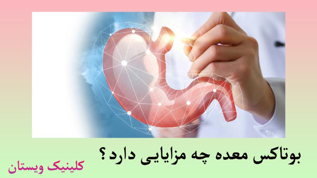 مزایای بوتاکس معده یک تصویر دیجیتالی از معده و یک پزشک که در حال نشان دادن قسمتی از آن است