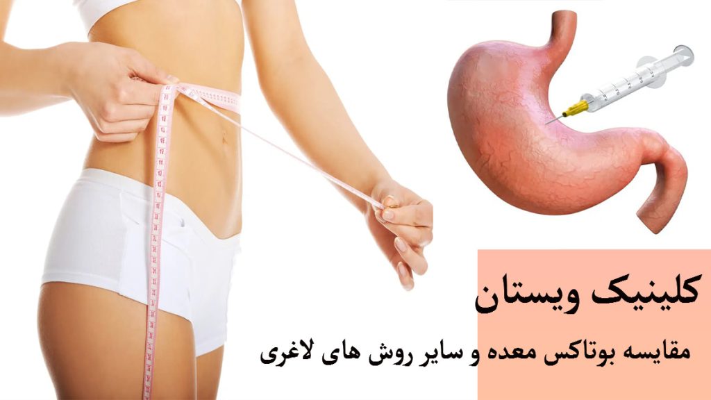 لاغری با بوتاکس معده دو تصویر در یک پس زمینه -یک خانم که متر را دور کمرش گرفته و تصویری انیمیشنی از تزریق بوتاکس به معده