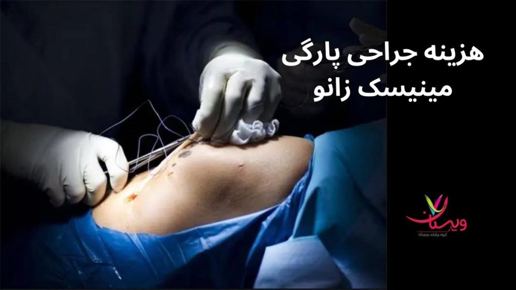 جراحی تست پارگی مینیسک زانو هزینه جراحی پارگی مینیسک زانو