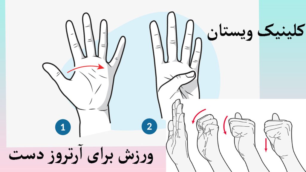 ورزش برای آرتروز دست چند ورزش برای درمان آرتروز دست نشان داده می شود
