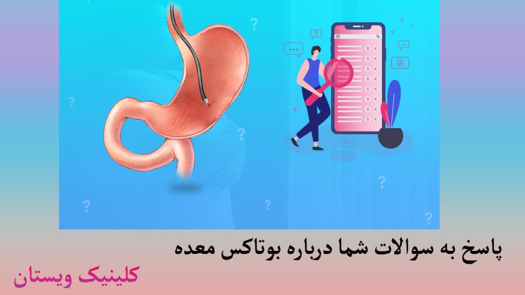 درباره بوتاکس معده یک تصویر از معده در کنار یک شخص -تصویر بصورت انیمیشنی است