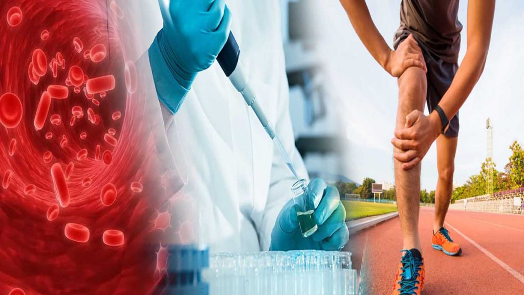 پس از عمل PRP، پزشک ممکن است به شما توصیه کند: در 3 روز اول هر 2 تا 3 ساعت به مدت 20 دقیقه روی زانوی خود یخ بگذارید