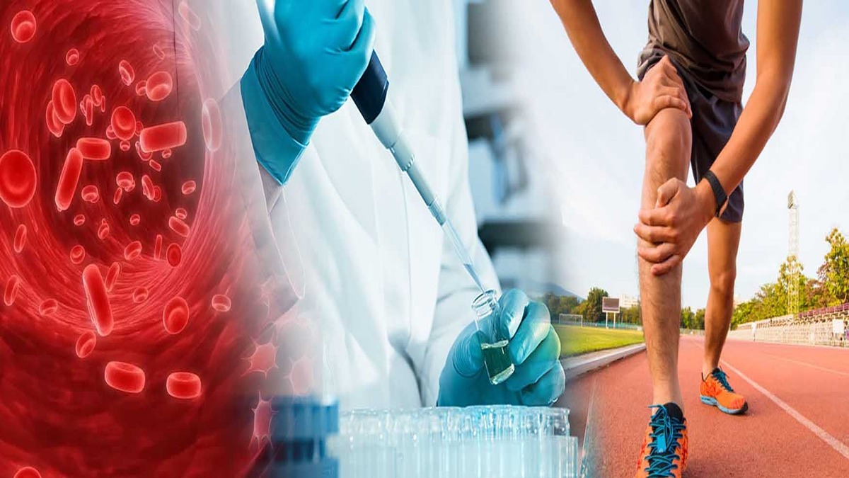 پس از عمل PRP، پزشک ممکن است به شما توصیه کند: در 3 روز اول هر 2 تا 3 ساعت به مدت 20 دقیقه روی زانوی خود یخ بگذارید