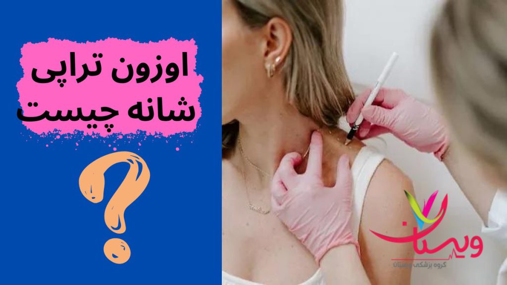 فرآیند تزریق اوزون برای شانه اوزون تراپی شانه چیست