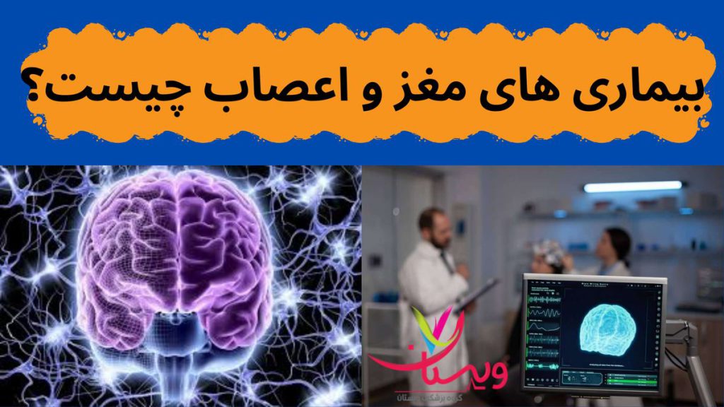 بیماری های مغزی بیماری های مغز و اعصاب چیست