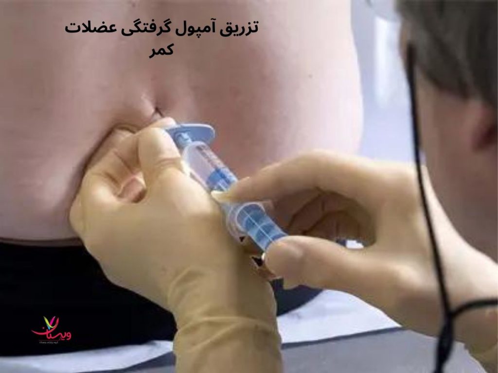 گرفتگی عضلات کمر تزریق امپول کرفتکی عضلات کمر
