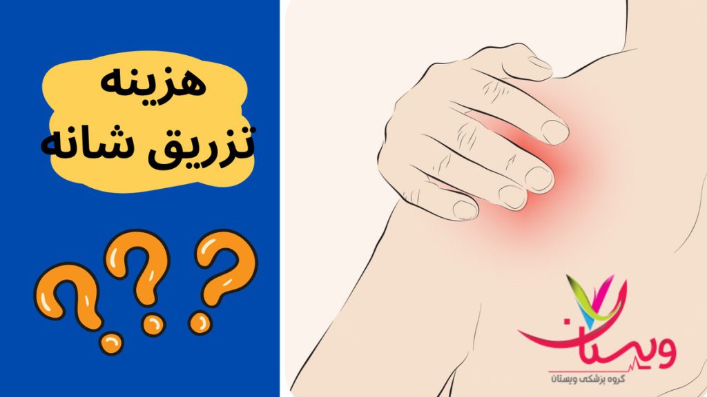 اوزون تراپی هزینه تزریق شانه