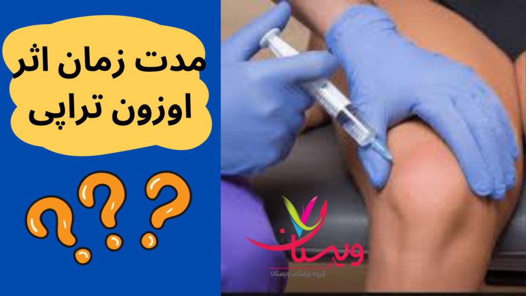 آرتروز زانو مدت زمان اثر اوزون تراپی