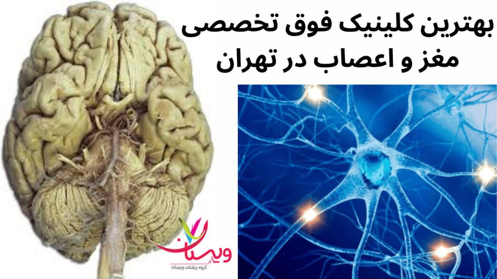مغز و اعصاب بهترین کلینیک فوق تخصصی مغز و اعصاب در تهران