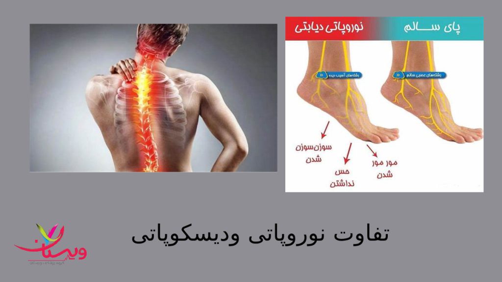 اختلالاتی که باعث درد در بدن می شوند پاهایی که دچار درد شده است براثر نوروپاتی و فردی که دچار درد ستوت فقرات است