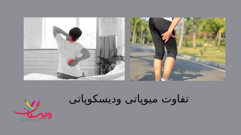 دو بیماری متفاوت با علل و علائم مختلف خانمی که پاهایش در اثر میوپاتی درد دارد واقایی که دچار درد ستون فقرات است