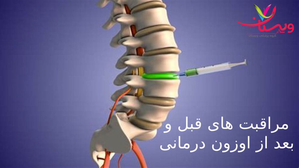 رعایت یک سری نکات قبل وبعد از اوزون تراپی تزریق گاز اوزون به ستون فقراتی که مشکال دارد