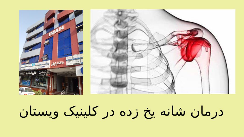بهترین متخصصان کلینیک ویستان برای درمان کپسولیت چسبنده شانه یخ زده خیراندیش