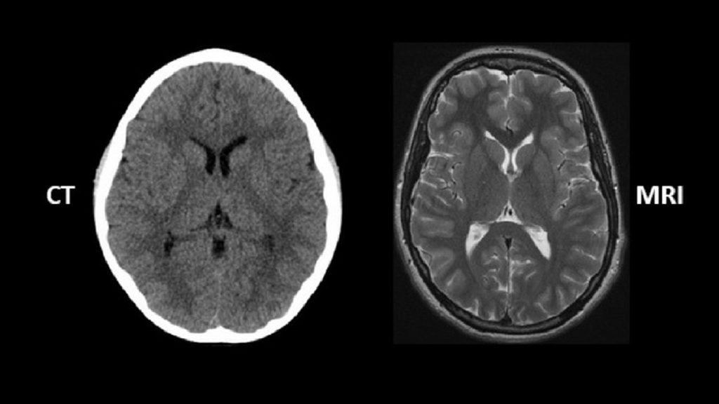 سی تی اسکن وام آر آی تفاوت دو روش تصویر برداری از مغز