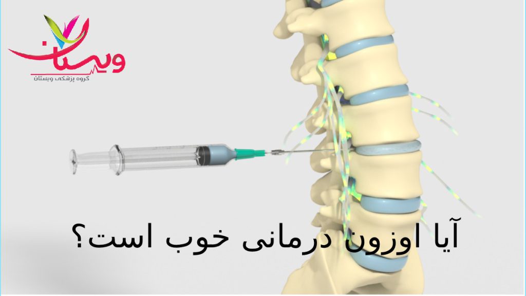 تسریع فرایند درمانی با گاز اوزون ستون فقراتی که دچار مشکل است وبا یک سرنگ در حال تزریق گاز اوزون به ناحیه مورد نظر است