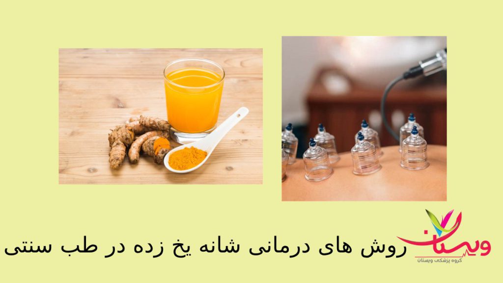 درمان سنتی کپسولیت چسبنده زنجبیل وزردچوبه وبادکش وحجامت مفصل شانه برای درمان چسبندگی شانه