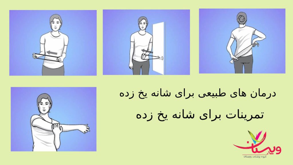 تمرینات کششی تمرینات ورزشی مناسب برای درمان شانه یخ زده