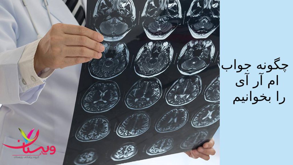 تفسیر جواب ام ار ای توسط متخصص تفسیر جواب ام ار ای توسط متخصص برای تشخیص دقیق مشکل