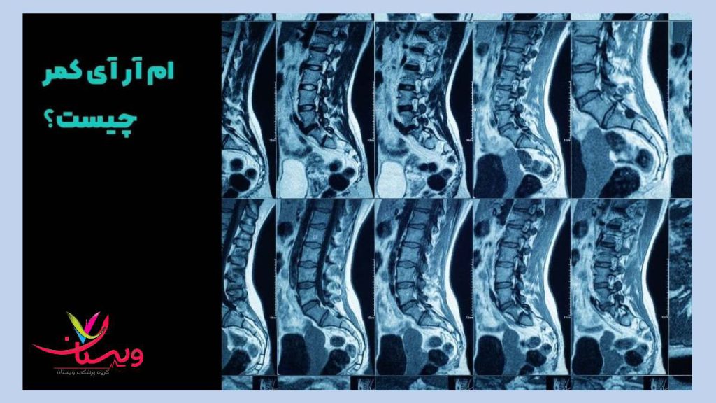 تصویر برداری از ستون فقرات ستون فقراتی که ام ار ای شده اند برای تشخیص نوع مشکل
