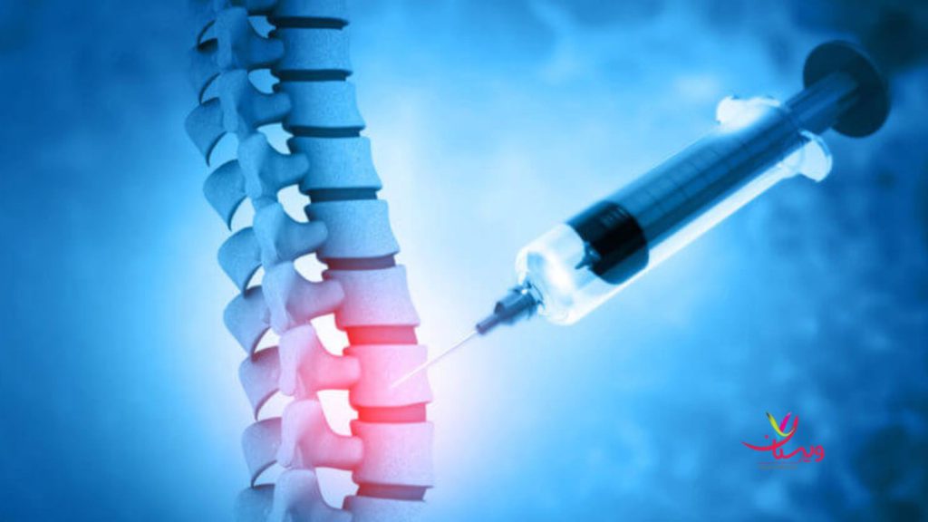 اوزون تراپی تنگی کانال نخاعی اوزون تراپی دیسک کمر و گردن چیست