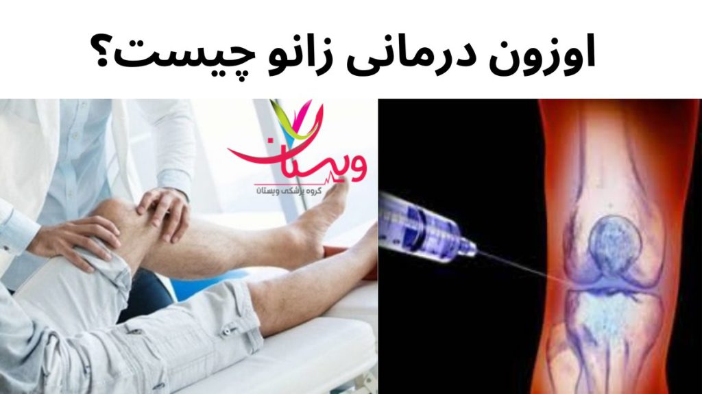 اوزون درمانی زانو اوزون درمانی زانو چیست