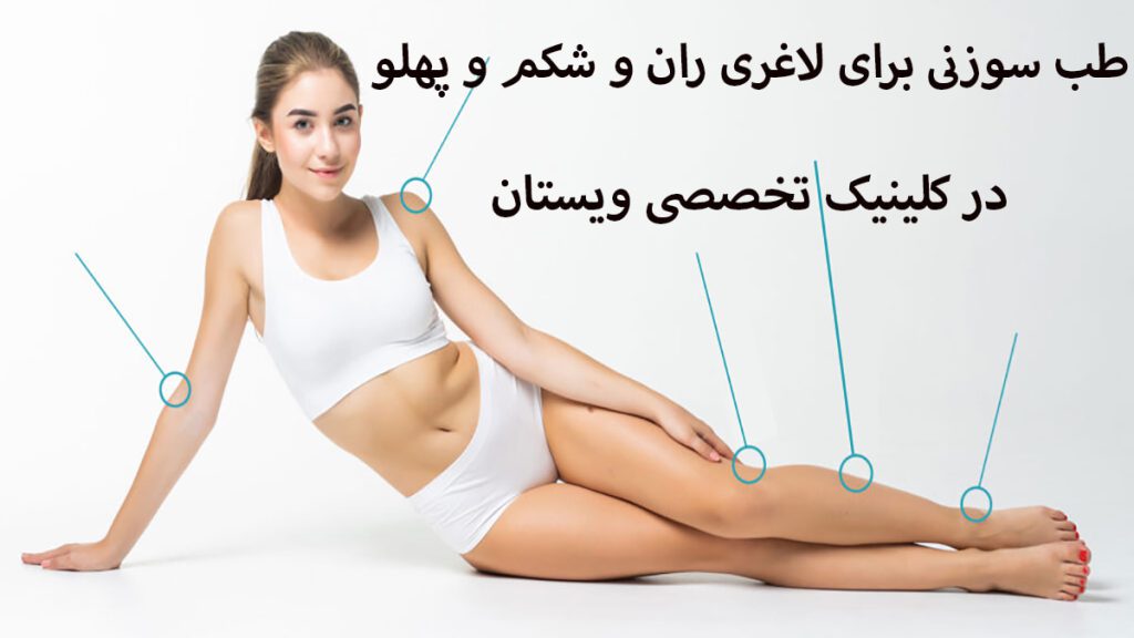 یک خانم که به پهلو نشسته است و نقاط قابل طب سوزنی لاغری بر روی بدن او مشخص شده است