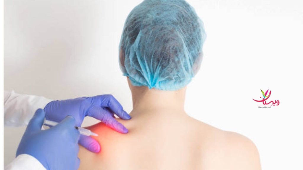 تزریق نادرست اوزون عوارض اوزون تراپی دیسک کمر