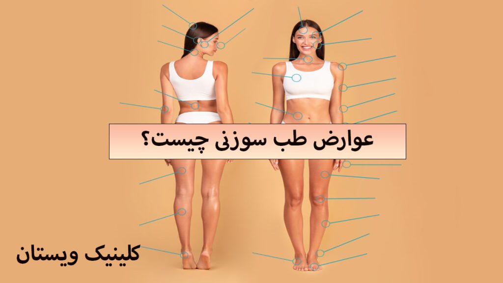 عوارض طب سوزنی دو تصویر از یک خانم بعد از انجام طب سوزنی لاغری