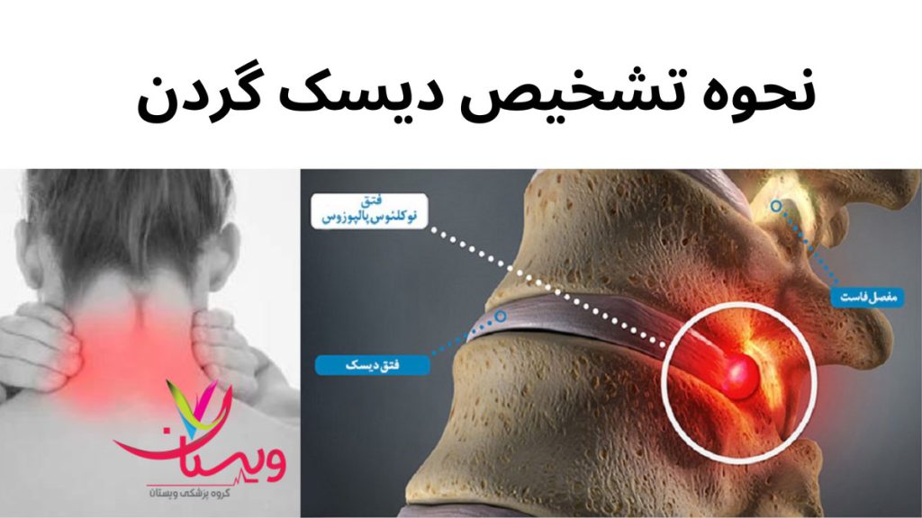 حرکات مختلف گردن نحوه تشخیص دیسک گردن