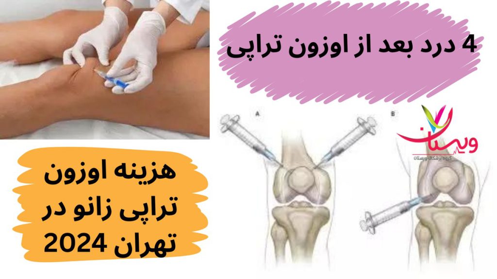 هزینه اوزون تراپی زانو در1403