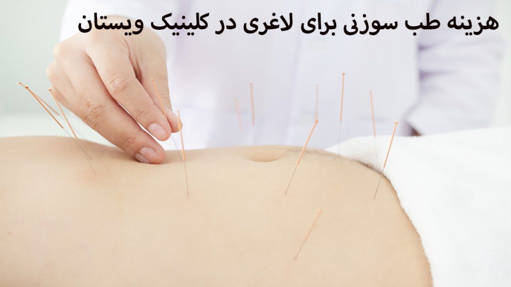 هزینه طب سوزنی یک شخص که دراز کشیده و پزشک در حال انجام طب سوزنی برای او می باشد