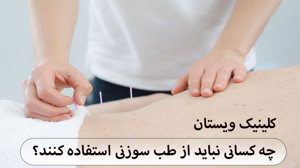 استفاده از طب سوزنی پزشک در حال انجام طب سوزنی شکم