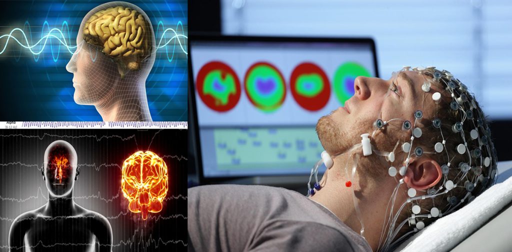 سکته مغزی: انسداد یا پارگی عروق مغزی که باعث اختلال در عملکرد مغز میشود. انجام نوار مغز در کلینیک ویستان