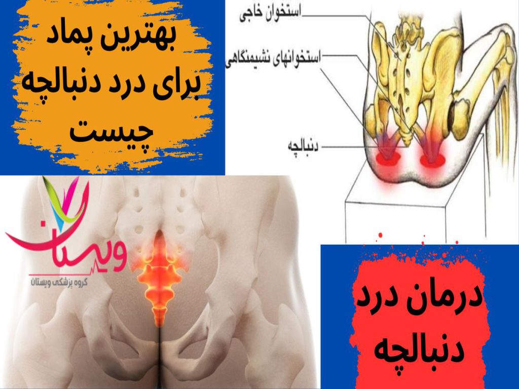 تسکین درد دنبالچه بهترین پماد برای درد دنبالچه چیست