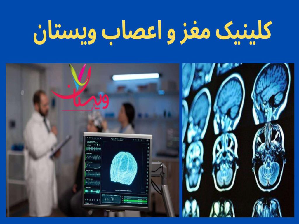 سیستم عصبی کلینیک مغز و اعصاب ویستان