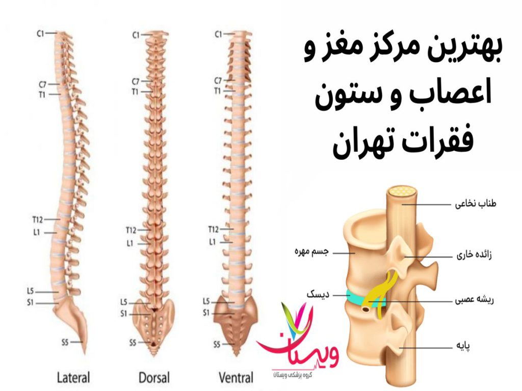 مغز و اعصاب و ستون فقرات بهترین مرکز مغز و اعصاب و ستون فقرات تهران