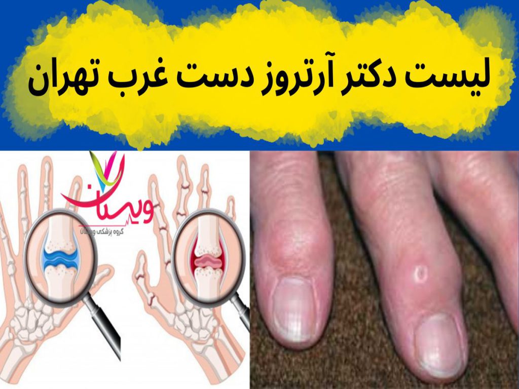 روماتولوژی و آرتروز لیست دکتر آرتروز دست غرب تهران