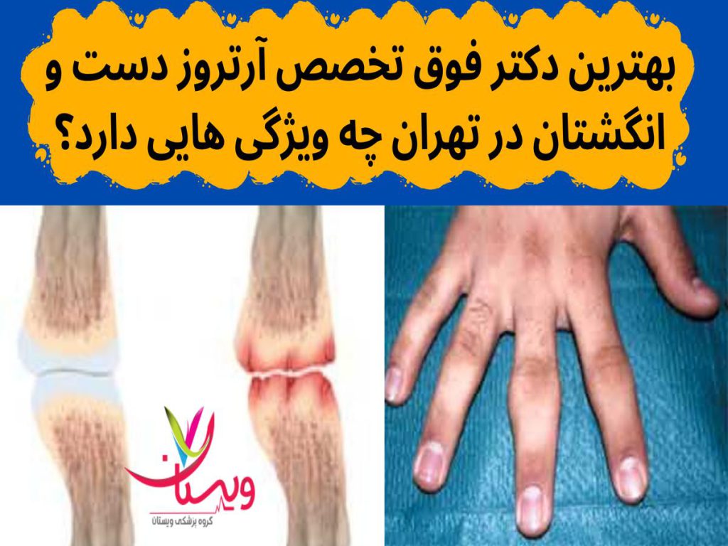 آرتروز دست و انگشتان بهترین دکتر فوق تخصص آرتروز دست و انگشتان در تهران چه ویژگی هایی دارد