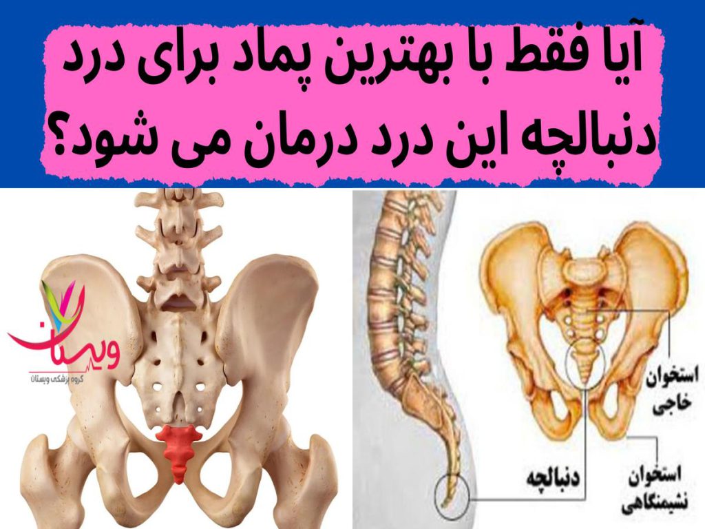 درمان مؤثر درد دنبالچه آیا فقط با بهترین پماد برای درد دنبالچه این درد درمان می شود