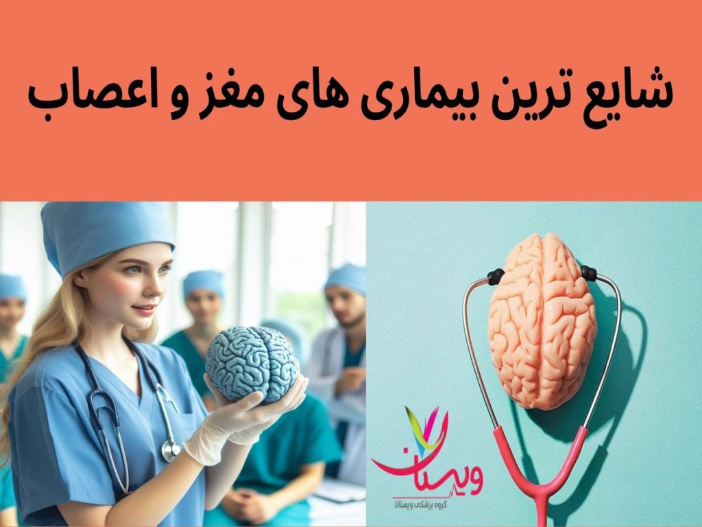 سکته مغزی شایع ترین بیماری های مغز و اعصاب