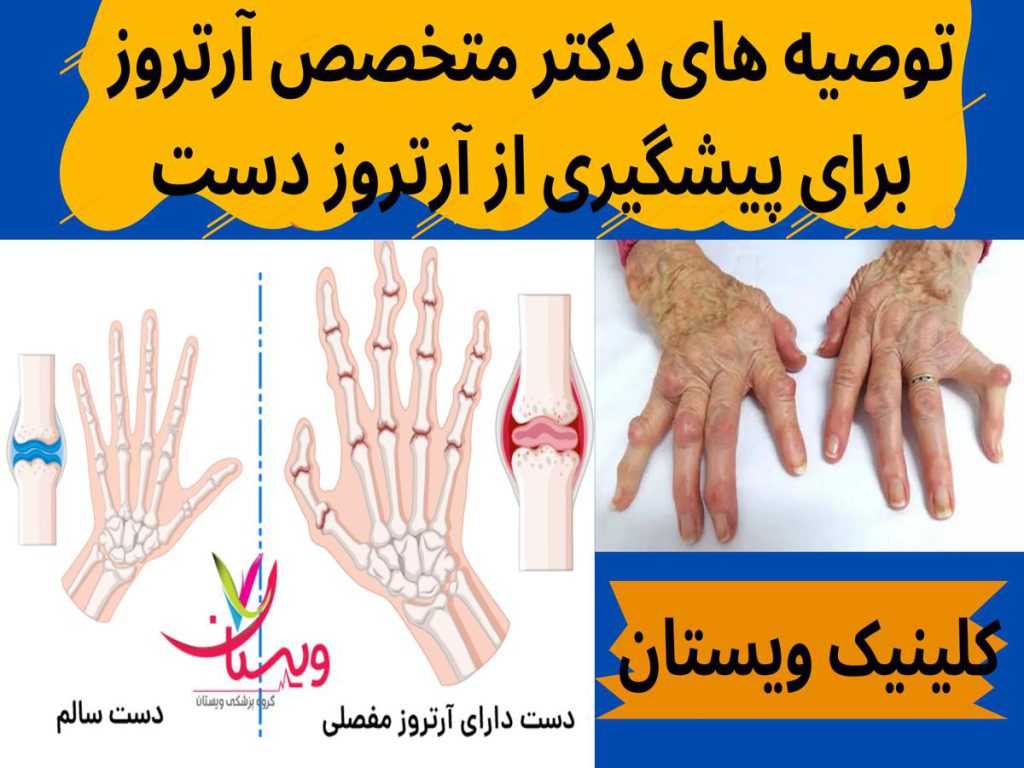 سلامت مفاصل توصیه های دکتر متخصص آرتروز برای پیشگیری از آرتروز دست