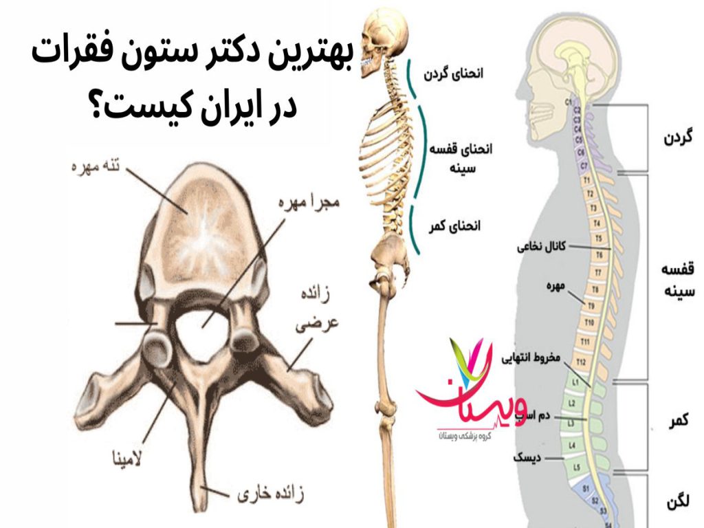 ستون فقرات بهترین دکتر ستون فقرات در ایران