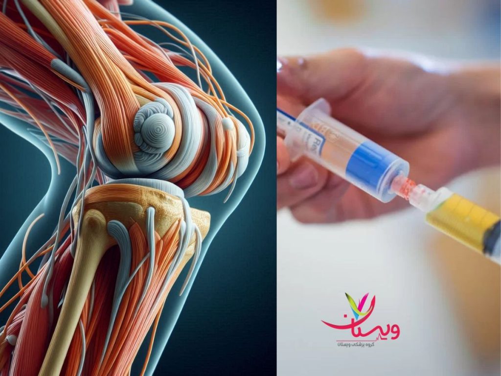 درد و التهاب و خطر عفونت عوارض درمان آرتروز با سلول های بنیادی