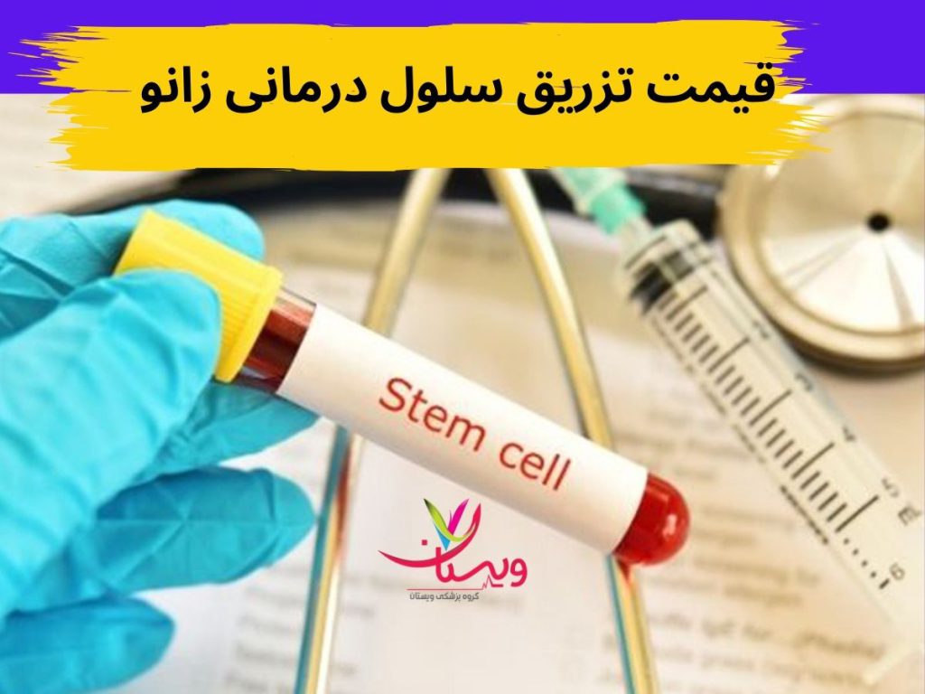 هزینه مفصل زانو هزینه تزریق سلول های بنیادی زانو