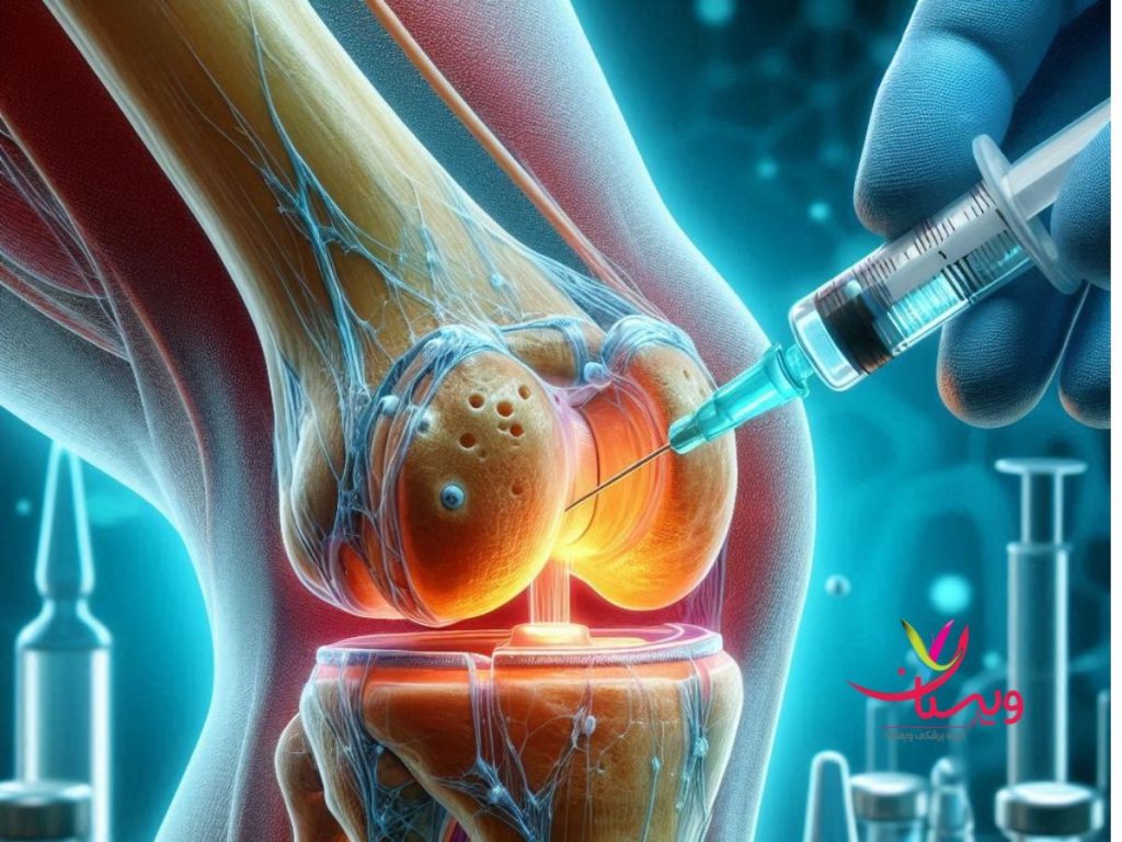 مزیت تزریق آمپول بنیادی به زانو مزایای تزریق آمپول سلول بنیادی زانو