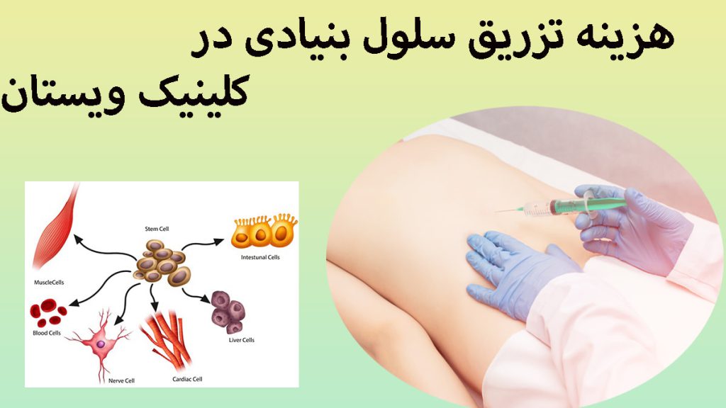 هزینه تزریق سلول بنیادی دو تصویر در یک قاب از سلول بنیادی و یک پزشک در حال تزریق به کمر