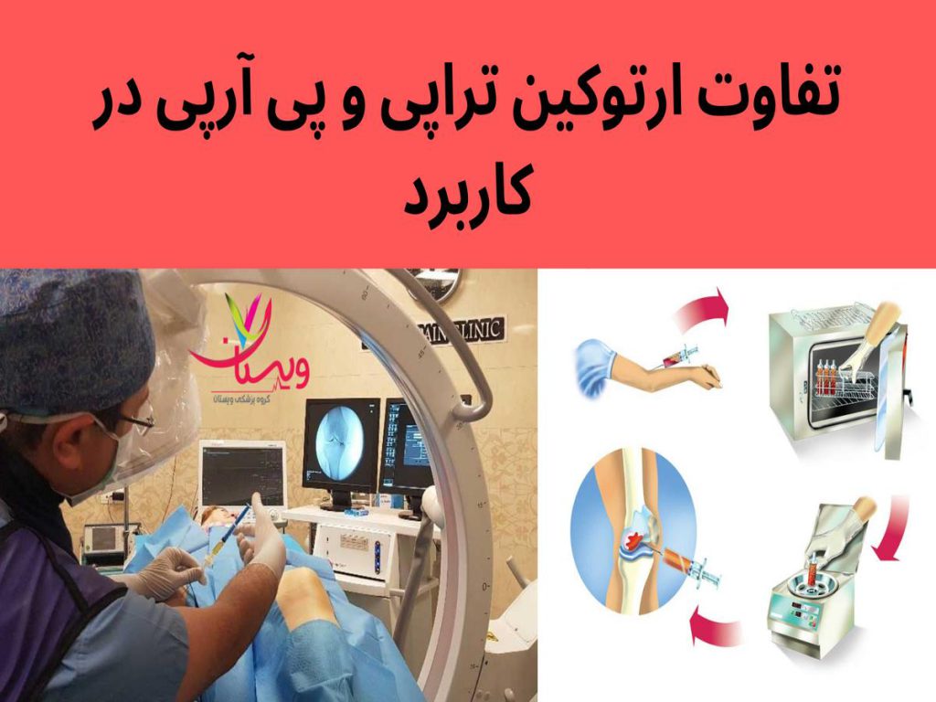 پلاکتهای غنی شده از خون بیمار تفاوت ارتوکین تراپی و پی آرپی در کاربرد